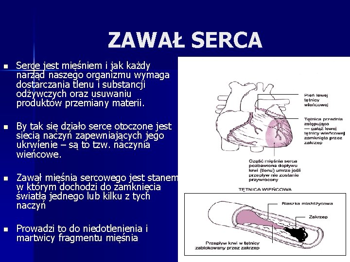 ZAWAŁ SERCA n Serce jest mięśniem i jak każdy narząd naszego organizmu wymaga dostarczania