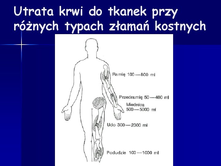 Utrata krwi do tkanek przy różnych typach złamań kostnych 