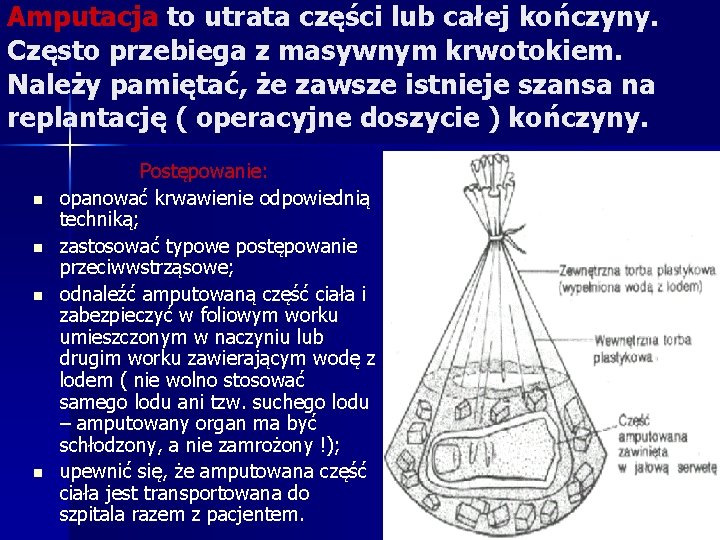 Amputacja to utrata części lub całej kończyny. Często przebiega z masywnym krwotokiem. Należy pamiętać,