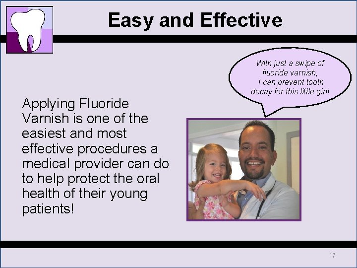 Easy and Effective Applying Fluoride Varnish is one of the easiest and most effective Easy and Effective Applying Fluoride Varnish is one of the easiest and most effective