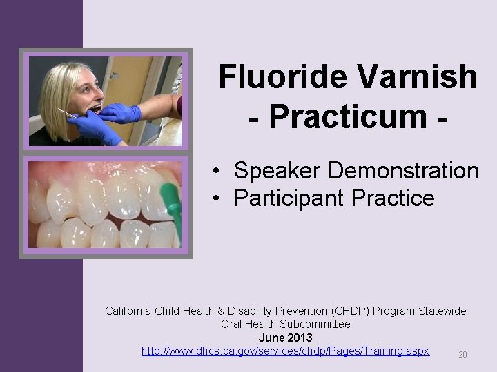 Fluoride Varnish - Practicum • Speaker Demonstration • Participant Practice California Child Health & Fluoride Varnish - Practicum • Speaker Demonstration • Participant Practice California Child Health &
