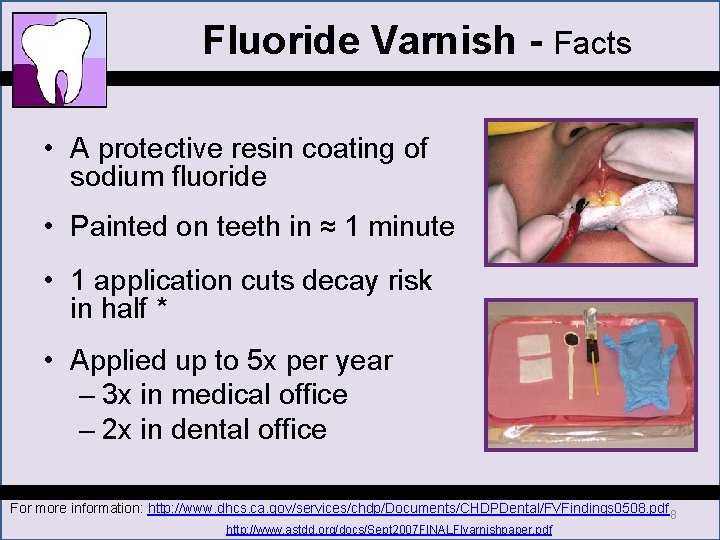 Fluoride Varnish - Facts • A protective resin coating of sodium fluoride • Painted Fluoride Varnish - Facts • A protective resin coating of sodium fluoride • Painted