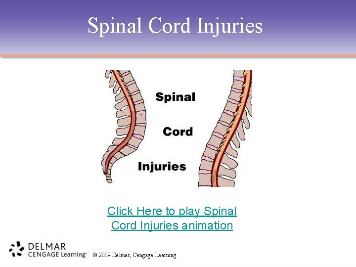 Spinal Cord Injuries Click Here to play Spinal Cord Injuries animation © 2009 Delmar,