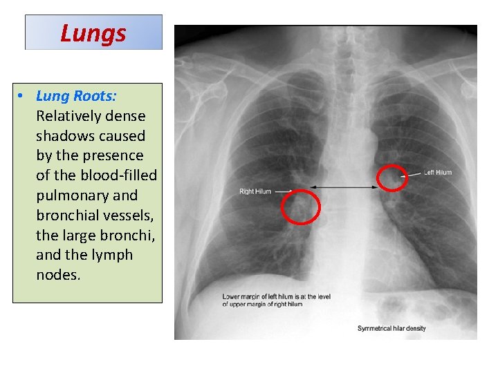 Lungs • Lung Roots: Relatively dense shadows caused by the presence of the blood-filled Lungs • Lung Roots: Relatively dense shadows caused by the presence of the blood-filled