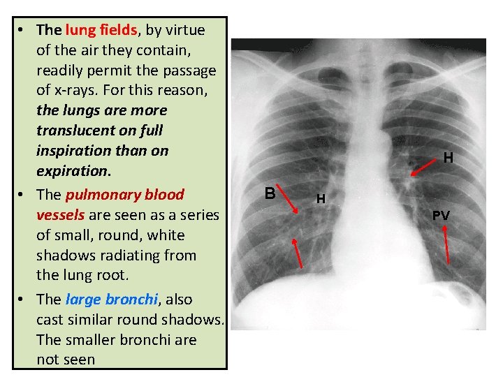 • The lung fields, by virtue of the air they contain, readily permit • The lung fields, by virtue of the air they contain, readily permit