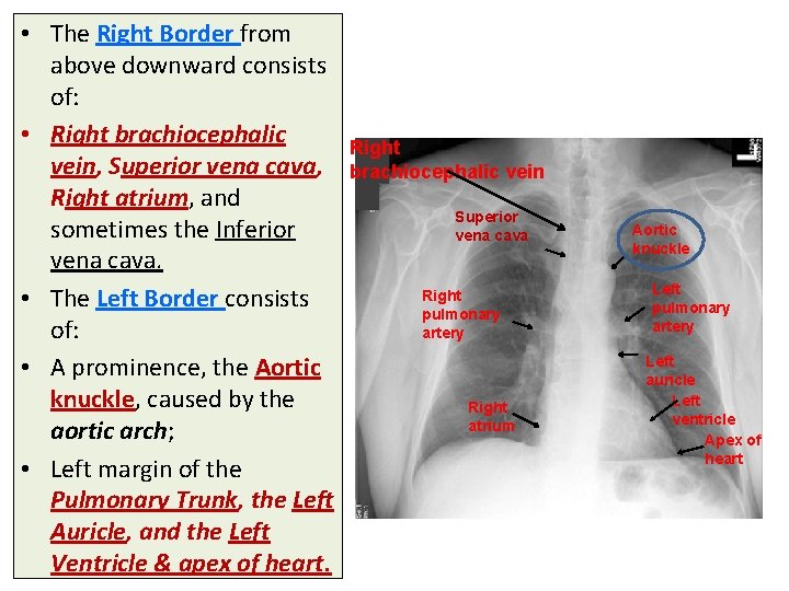 • The Right Border from above downward consists of: • Right brachiocephalic vein, • The Right Border from above downward consists of: • Right brachiocephalic vein,