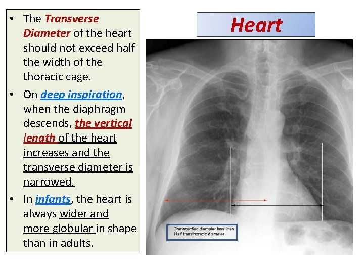 • The Transverse Diameter of the heart should not exceed half the width • The Transverse Diameter of the heart should not exceed half the width