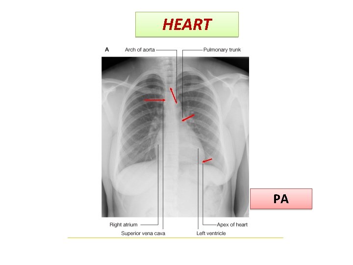 HEART PA HEART PA