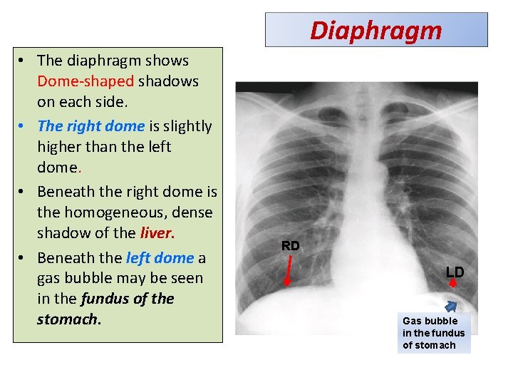 Diaphragm • The diaphragm shows Dome-shaped shadows on each side. • The right dome Diaphragm • The diaphragm shows Dome-shaped shadows on each side. • The right dome