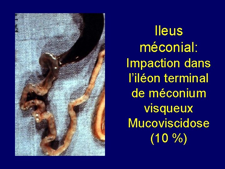 IIA Conduite tenir devant des vomissements chez lenfant