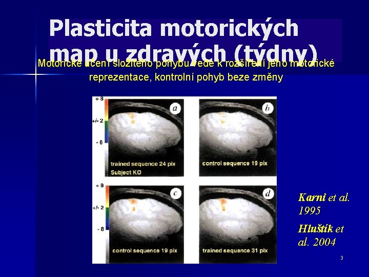 Plasticita motorických map u zdravých (týdny) Motorické učení složitého pohybu vede k rozšíření jeho