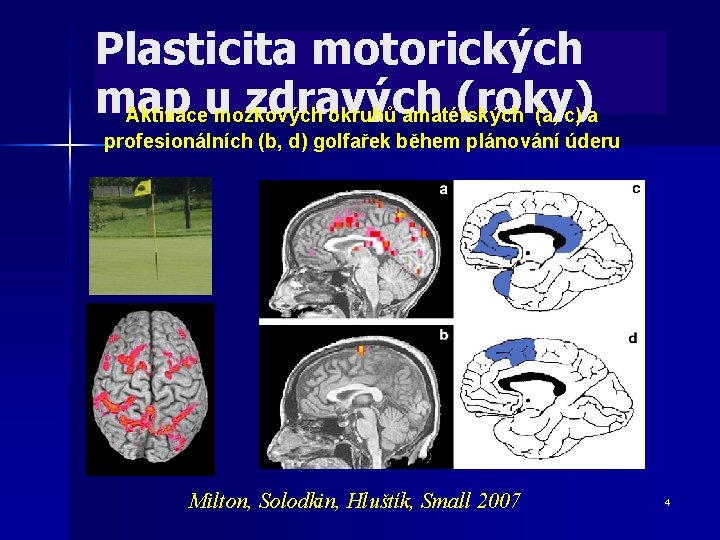 Plasticita motorických map zdravých (roky) Aktivaceu mozkových okruhů amatérských (a, c) a profesionálních (b,