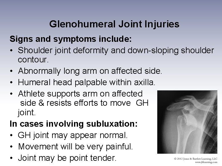 Glenohumeral Joint Injuries Signs and symptoms include: • Shoulder joint deformity and down-sloping shoulder