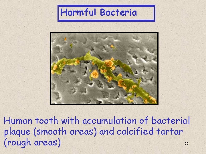  Harmful Bacteria Human tooth with accumulation of bacterial plaque (smooth areas) and calcified