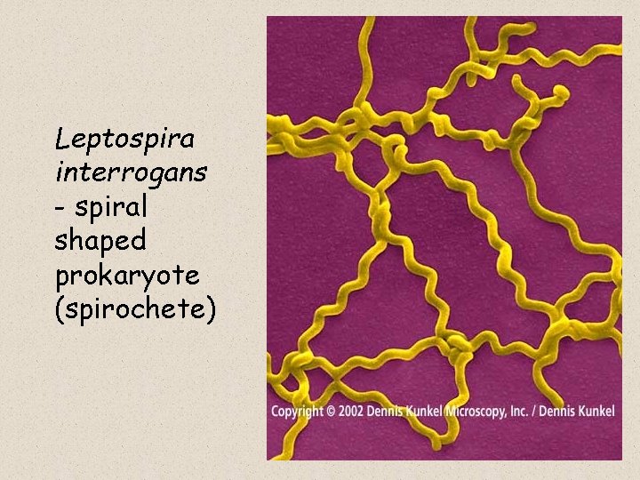Leptospira interrogans - spiral shaped prokaryote (spirochete) 35 