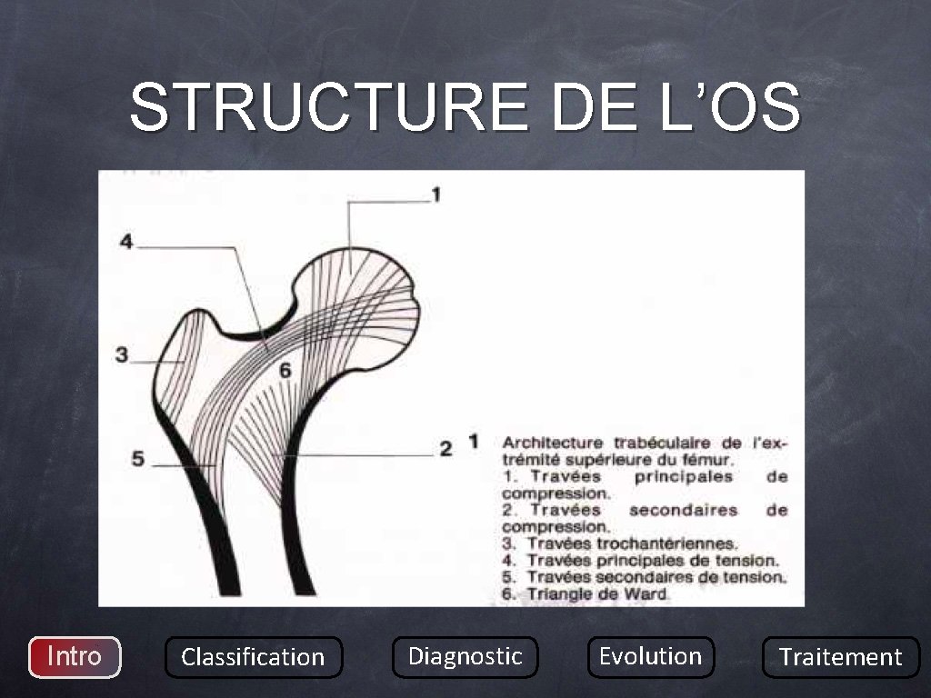STRUCTURE DE L’OS Intro Classification Diagnostic Evolution Traitement 