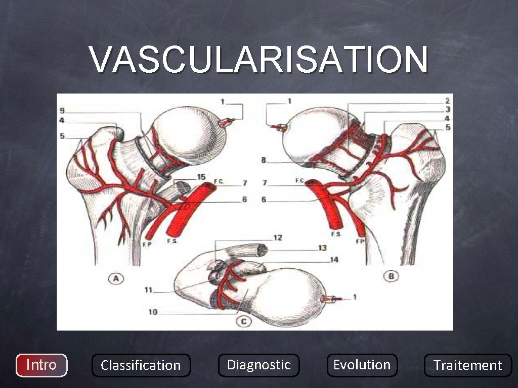 VASCULARISATION Intro Classification Diagnostic Evolution Traitement 