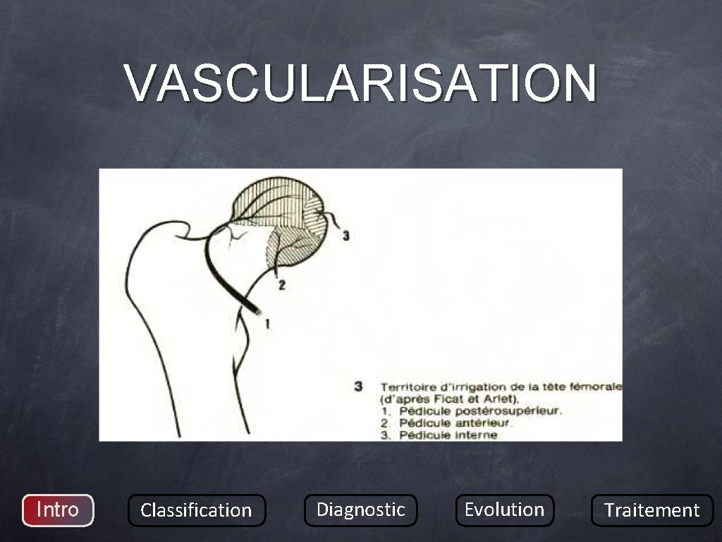 VASCULARISATION Intro Classification Diagnostic Evolution Traitement 
