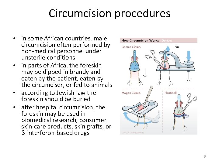 Circumcision procedures • in some African countries, male circumcision often performed by non-medical personnel