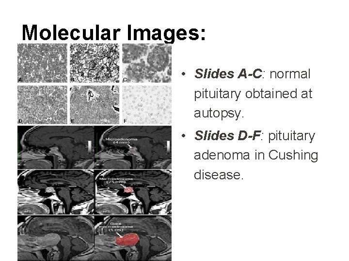 Molecular Images: • Slides A-C: normal pituitary obtained at autopsy. • Slides D-F: pituitary