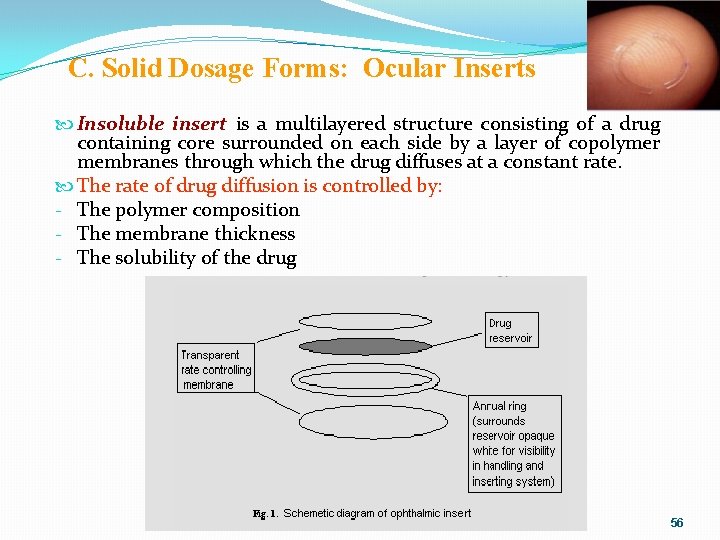 C. Solid Dosage Forms: Ocular Inserts Insoluble insert is a multilayered structure consisting of