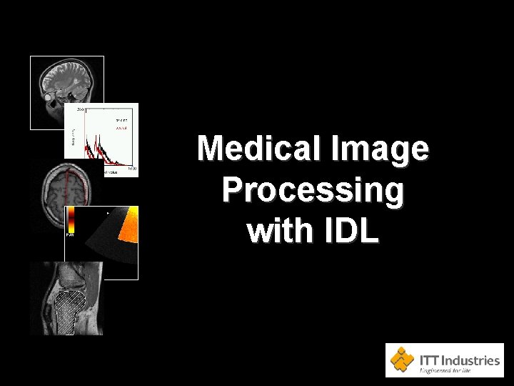 Medical Image Processing with IDL 