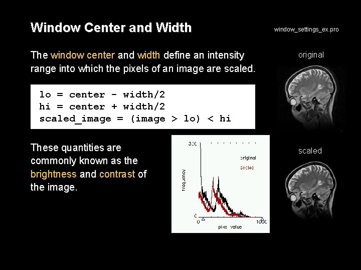 Window Center and Width The window center and width define an intensity range into