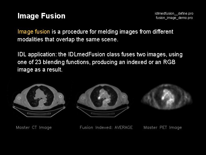 Image Fusion idlmedfusion__define. pro fusion_image_demo. pro Image fusion is a procedure for melding images