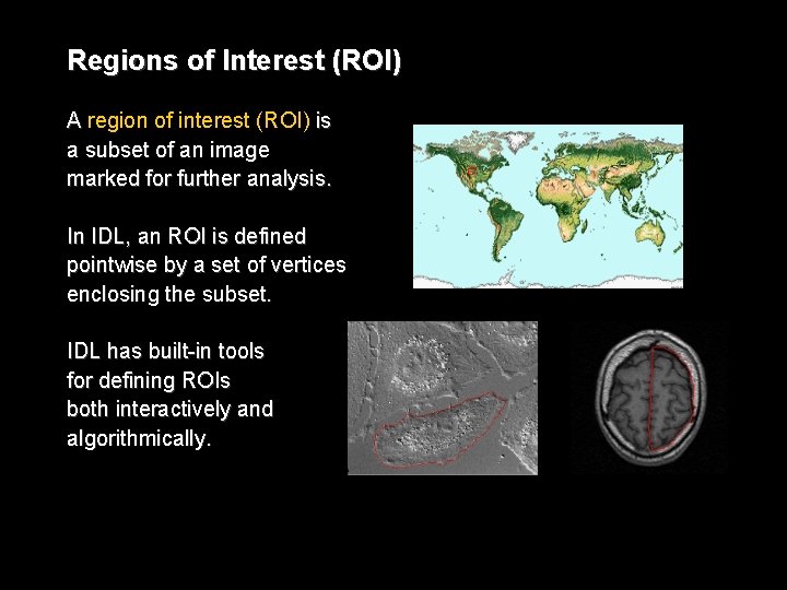 Regions of Interest (ROI) A region of interest (ROI) is a subset of an