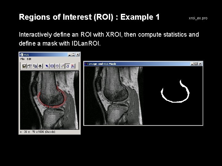 Regions of Interest (ROI) : Example 1 xroi_ex. pro Interactively define an ROI with