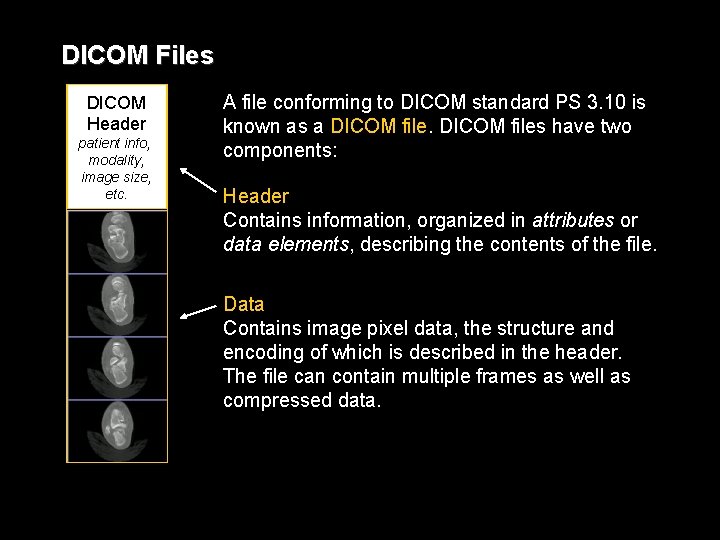 DICOM Files DICOM Header patient info, modality, image size, etc. A file conforming to