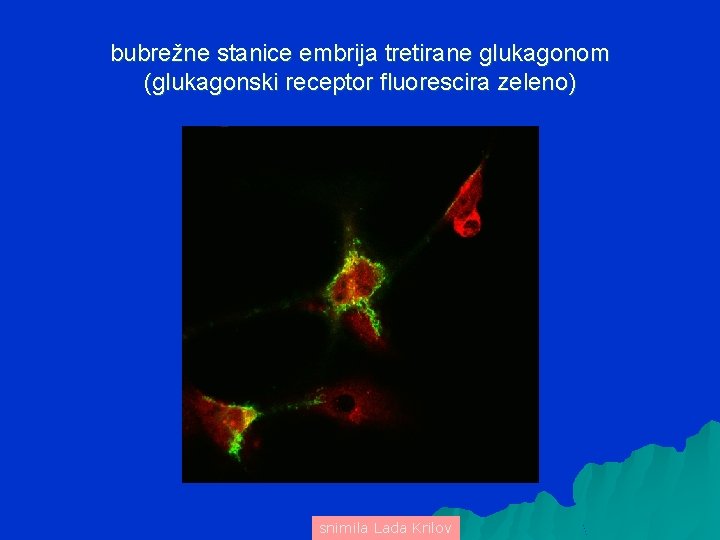 bubrežne stanice embrija tretirane glukagonom (glukagonski receptor fluorescira zeleno) snimila Lada Krilov 