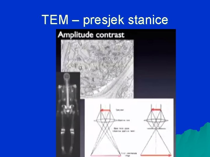 TEM – presjek stanice 