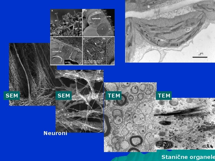 SEM TEM Neuroni Stanične organele 