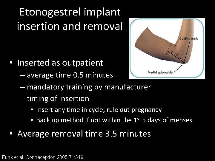 Etonogestrel implant insertion and removal • Inserted as outpatient – average time 0. 5