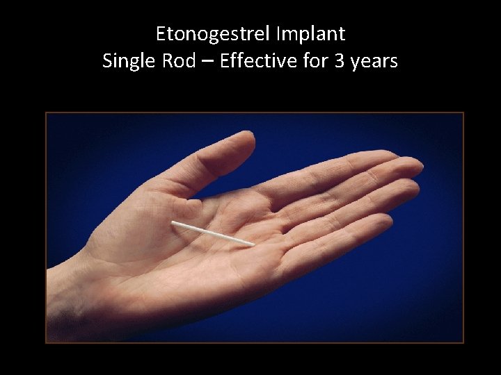 Etonogestrel Implant Single Rod – Effective for 3 years 
