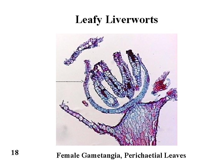 Leafy Liverworts 18 Female Gametangia, Perichaetial Leaves 