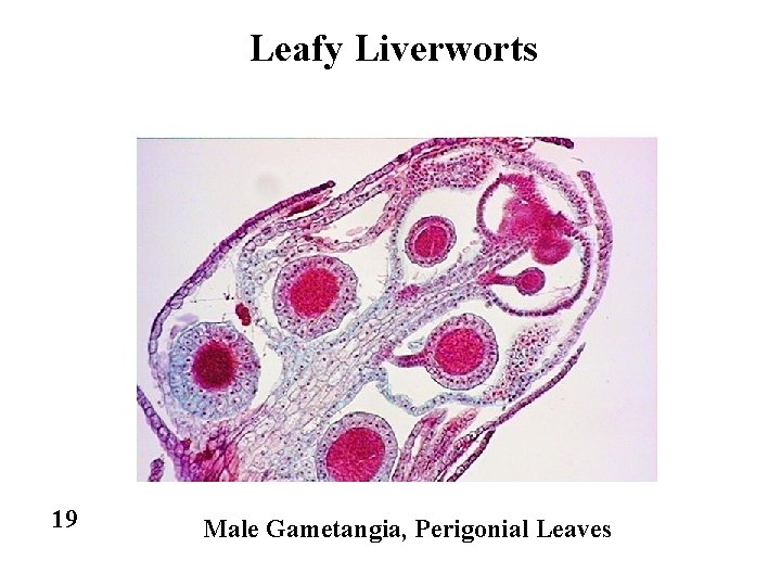 Leafy Liverworts 19 Male Gametangia, Perigonial Leaves 