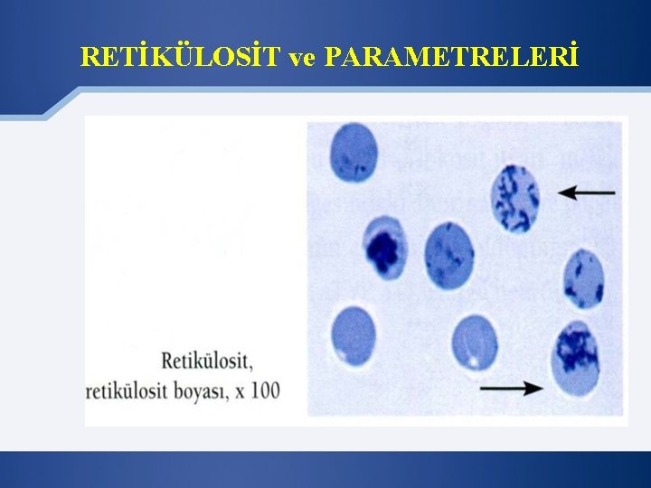 RETİKÜLOSİT ve PARAMETRELERİ 