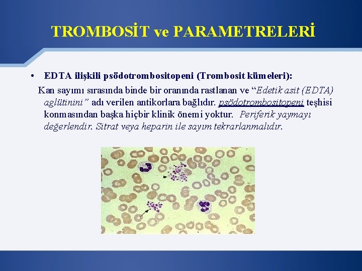 TROMBOSİT ve PARAMETRELERİ • EDTA ilişkili psödotrombositopeni (Trombosit kümeleri): Kan sayımı sırasında binde bir