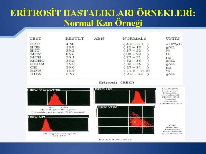 ERİTROSİT HASTALIKLARI ÖRNEKLERİ: Normal Kan Örneği 