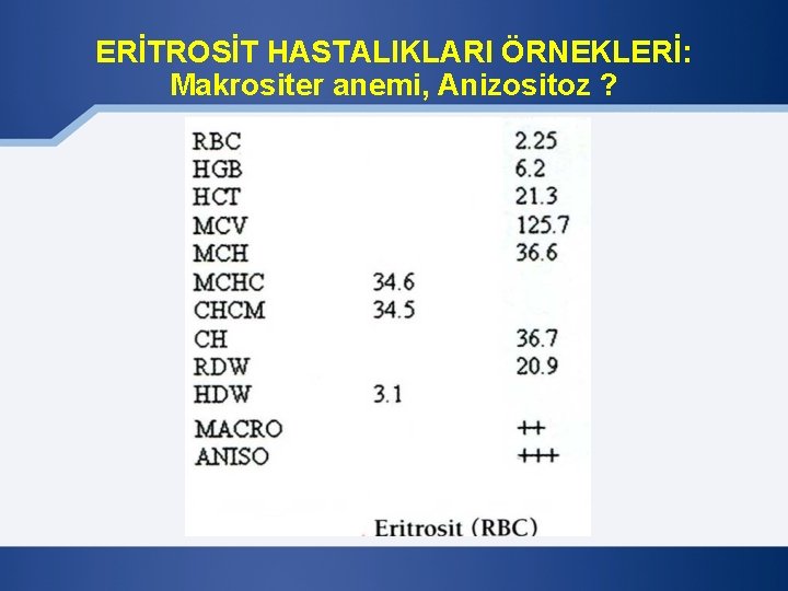 ERİTROSİT HASTALIKLARI ÖRNEKLERİ: Makrositer anemi, Anizositoz ? 