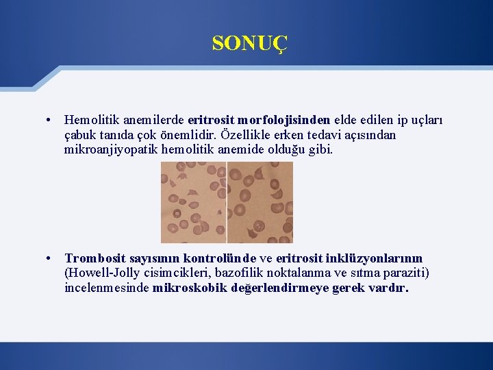 SONUÇ • Hemolitik anemilerde eritrosit morfolojisinden elde edilen ip uçları çabuk tanıda çok önemlidir.