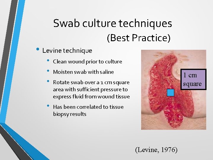 Wound Management in the Elderly Stephanie Yates MSN