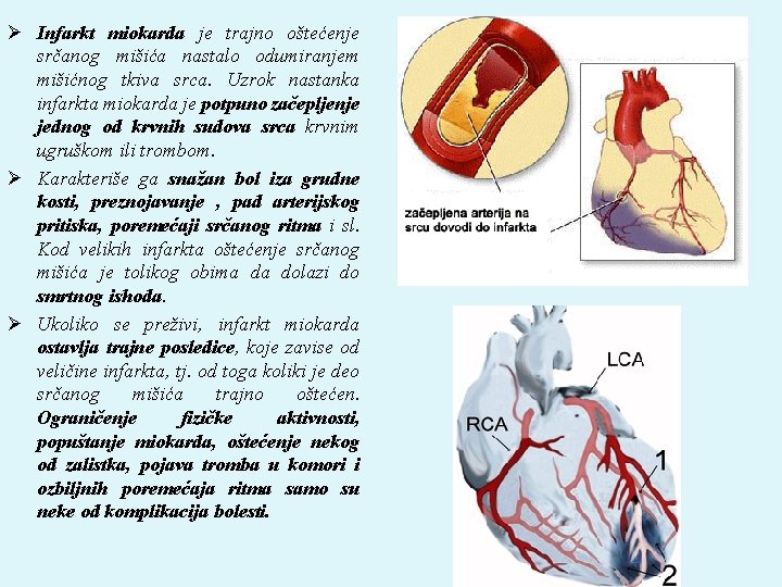 Ø Infarkt miokarda je trajno oštećenje srčanog mišića nastalo odumiranjem mišićnog tkiva srca. Uzrok