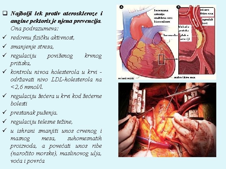 q Najbolji lek protiv ateroskleroze i angine pektoris je njena prevencija. Ona podrazumeva: ü