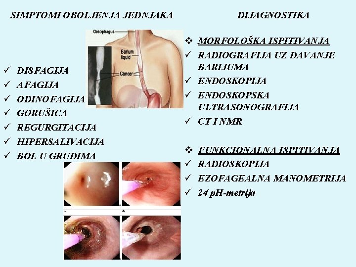 SIMPTOMI OBOLJENJA JEDNJAKA DIJAGNOSTIKA ü ü ü ü DISFAGIJA AFAGIJA ODINOFAGIJA GORUŠICA REGURGITACIJA HIPERSALIVACIJA