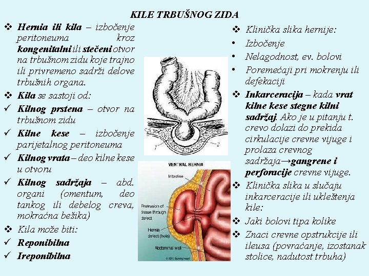 v v ü ü KILE TRBUŠNOG ZIDA Hernia ili kila – izbočenje v peritoneuma