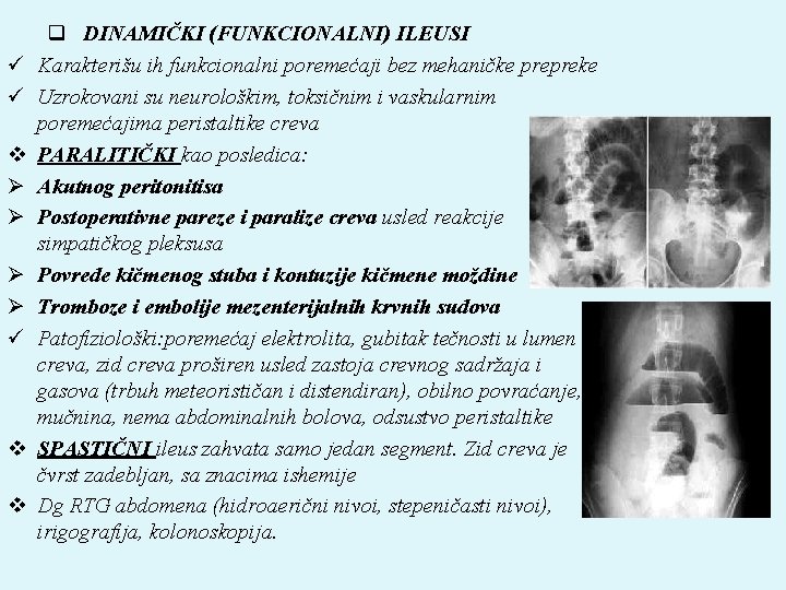 ü ü v Ø Ø ü v v q DINAMIČKI (FUNKCIONALNI) ILEUSI Karakterišu ih