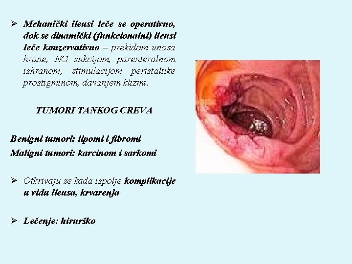 Ø Mehanički ileusi leče se operativno, dok se dinamički (funkcionalni) ileusi leče konzervativno –